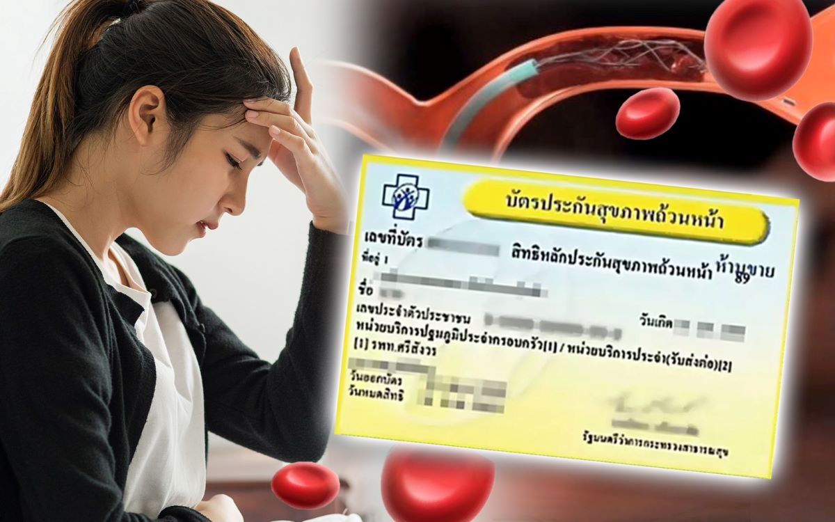 บัตรทองเพิ่มสิทธิการรักษา หลอดเลือดอุดตัน